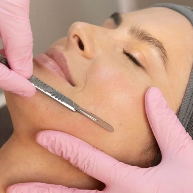 dermaplaning